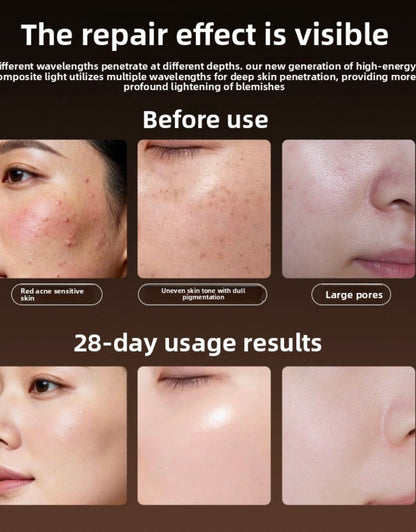 SKIN FRIENDLY BEAUTYMASK